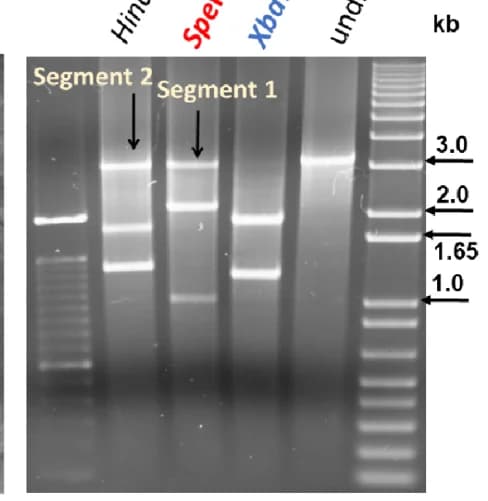 Open access visualization of Gel, Agarose Gel, Restriction Endonucleases, DNA Digestion