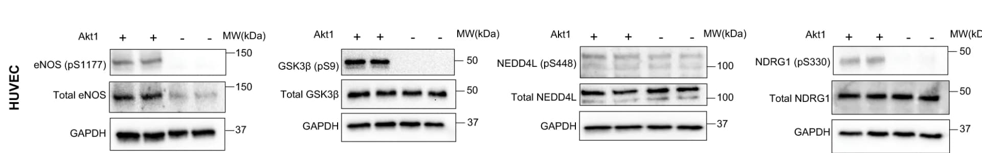 Open access visualization of Gel, Western Blot Analysis, Kinase Assay, Akt1 Substrates, Phosphorylation Sites