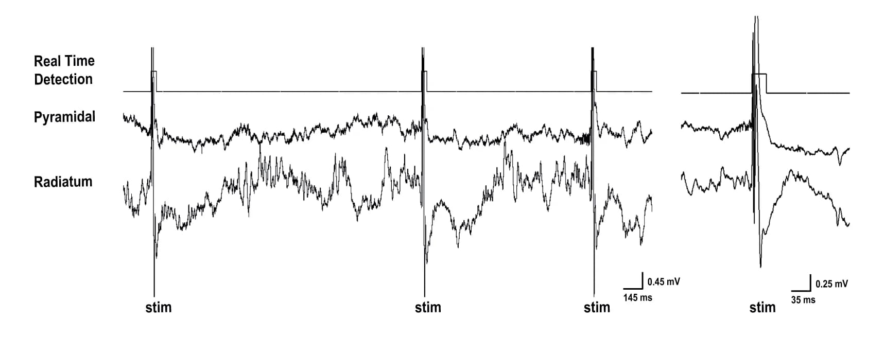 Open access visualization of Line Plot, LFP Signals, Dorsal Hippocampus, SWR Events