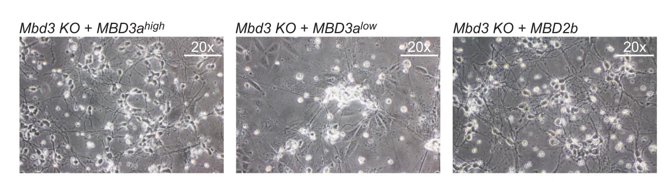 Open access visualization of Microscopy, Microscopy Images, Neurons, Mbd3 KO, ESCs