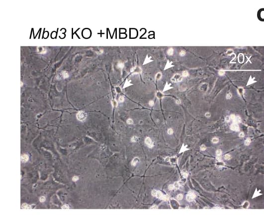 Open access visualization of Microscopy, Microscopy Images, In Vitro Derived Neurons, Mbd3 KO, Magnification
