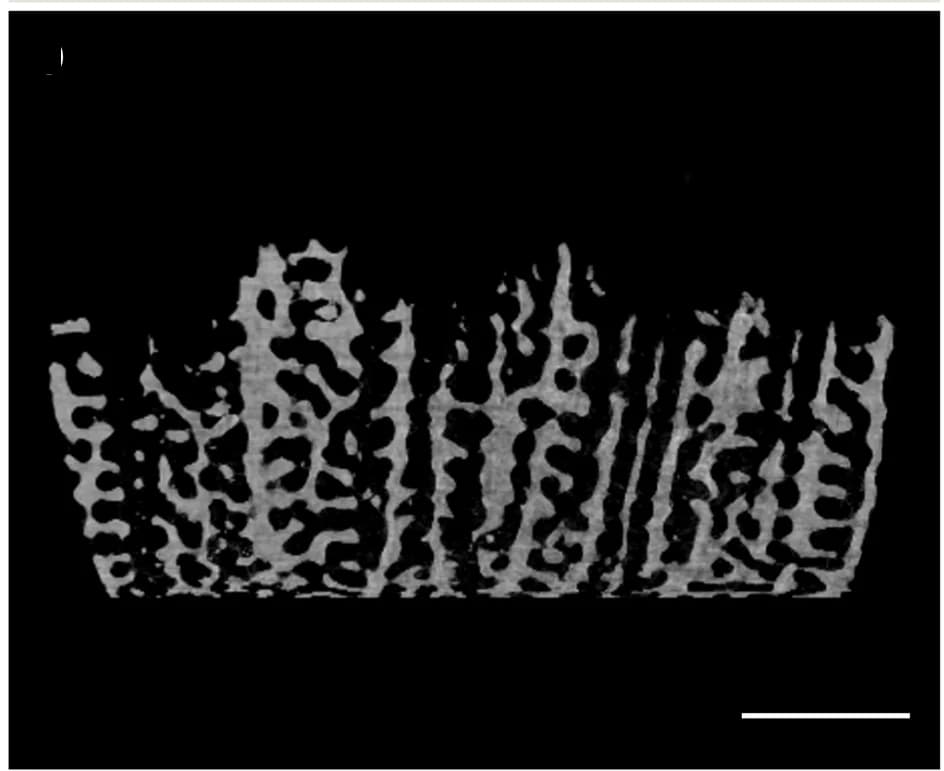 Open access visualization of Microscopy, Tomography Slices, Skeleton Architecture, Polyp Volumetric Thickness, Hardness