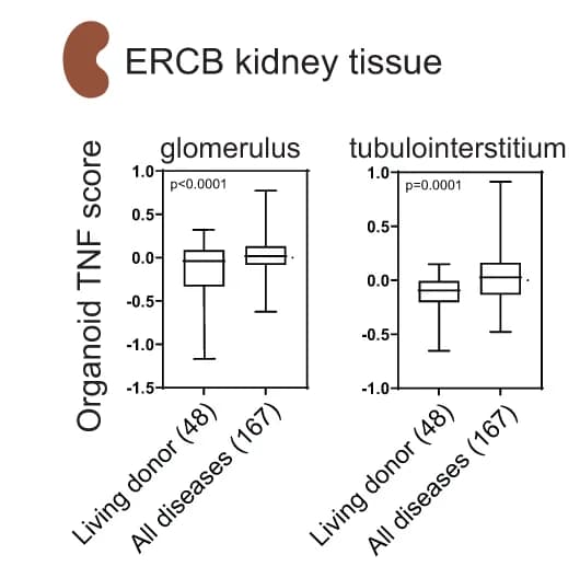 Open access visualization of Box Plot, Z-scores, Organoid TNF signature genes, Human kidney diseases, ERCB microarray data