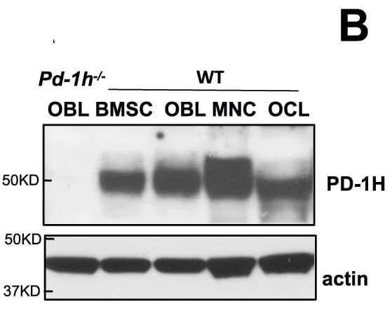 Open access visualization of Gel, WB, PD-1H expression, BMCs, Stromal Cells