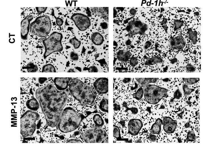 Open access visualization of Microscopy, TRAP staining, OCL formation, BMCs, Mice