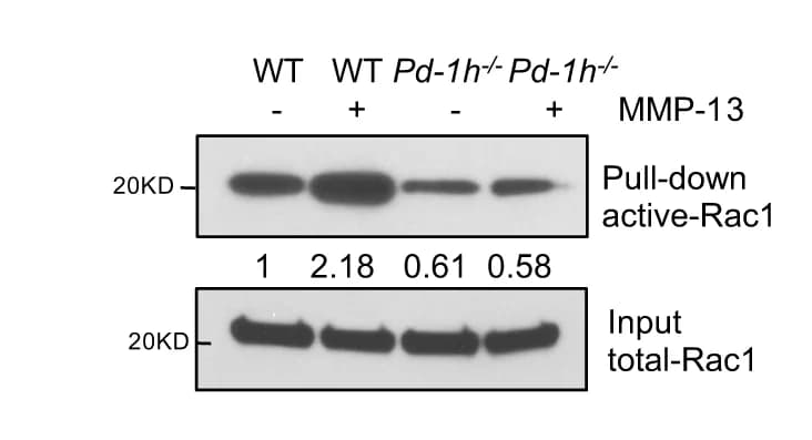 Open access visualization of Gel, BMMNCs, WT Mice, Pd-1h -/- Mice, OCL Differentiation