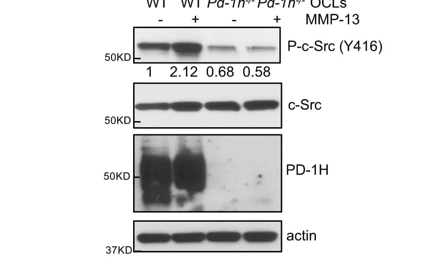 Open access visualization of Gel, BMMNCs, WT Mice, Pd-1h -/- Mice, OCL Differentiation Medium