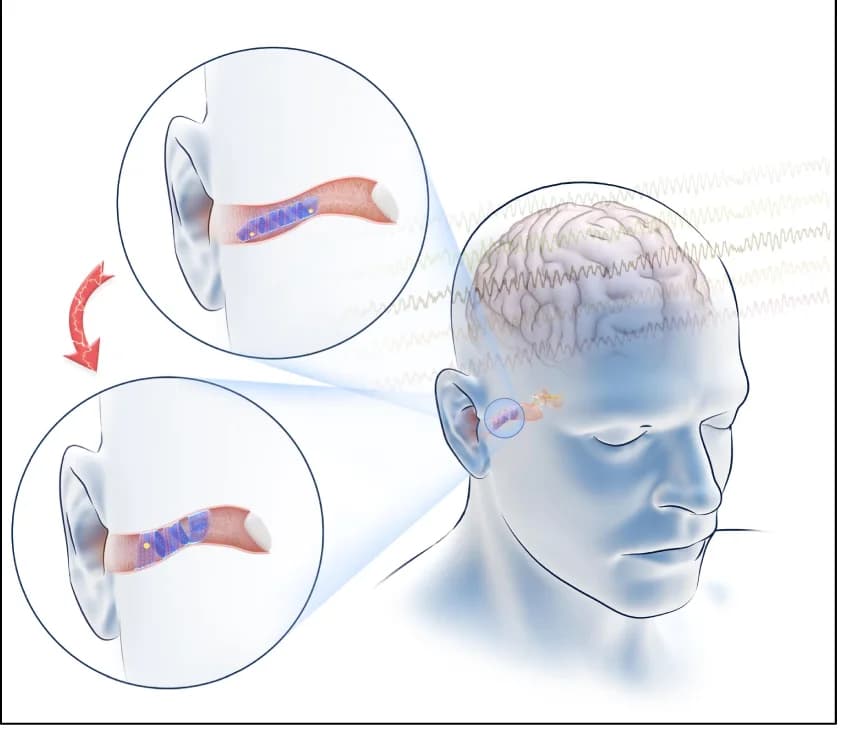 Open access visualization of Illustration, In-Ear EEG Recording, SpiralE, Schematic Diagram