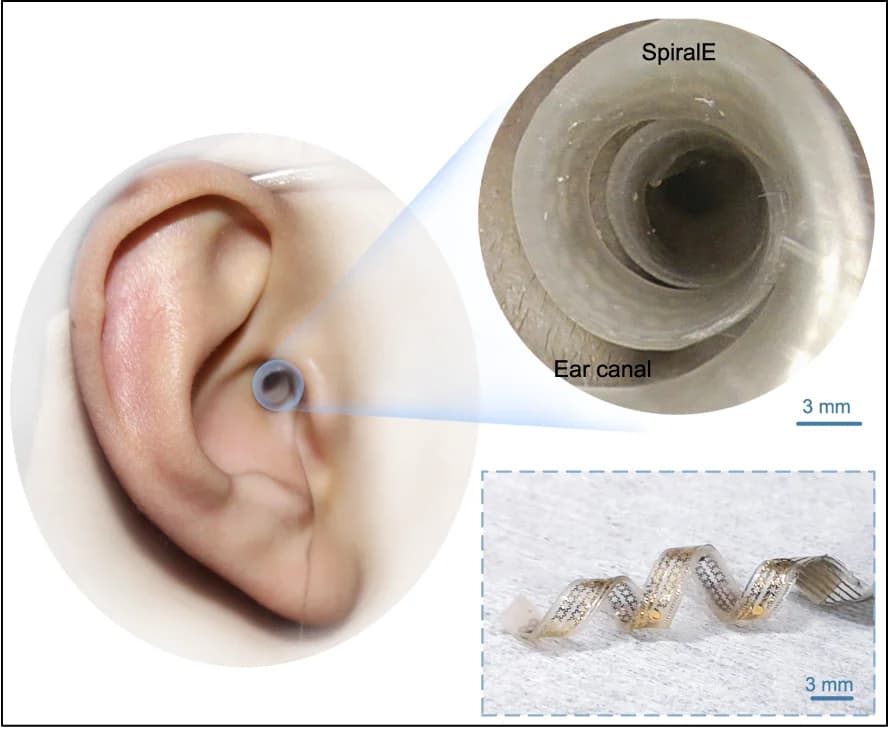 Open access visualization of Photo, SpiralE, Ear Canal, Medical Endoscope, 3D Structure