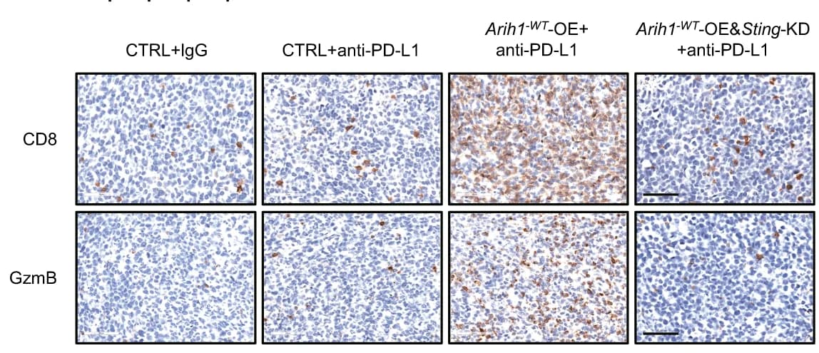 Open access visualization of Microscopy, CD8 IHC Staining, GzmB IHC Staining, Tumors