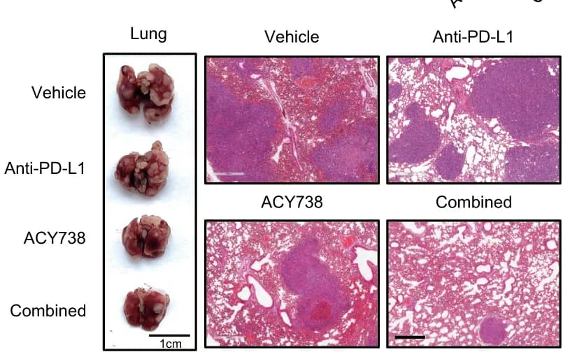 Open access visualization of Microscopy, Photo, Spontaneous Lung Metastases, BALB/c Mice, 4T1 Cells