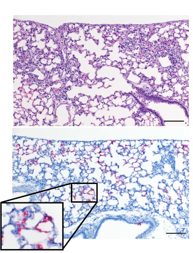 Open access visualization of Microscopy, H&E Staining, In-Situ Hybridization, SARS-CoV-2, Nucleic Acid