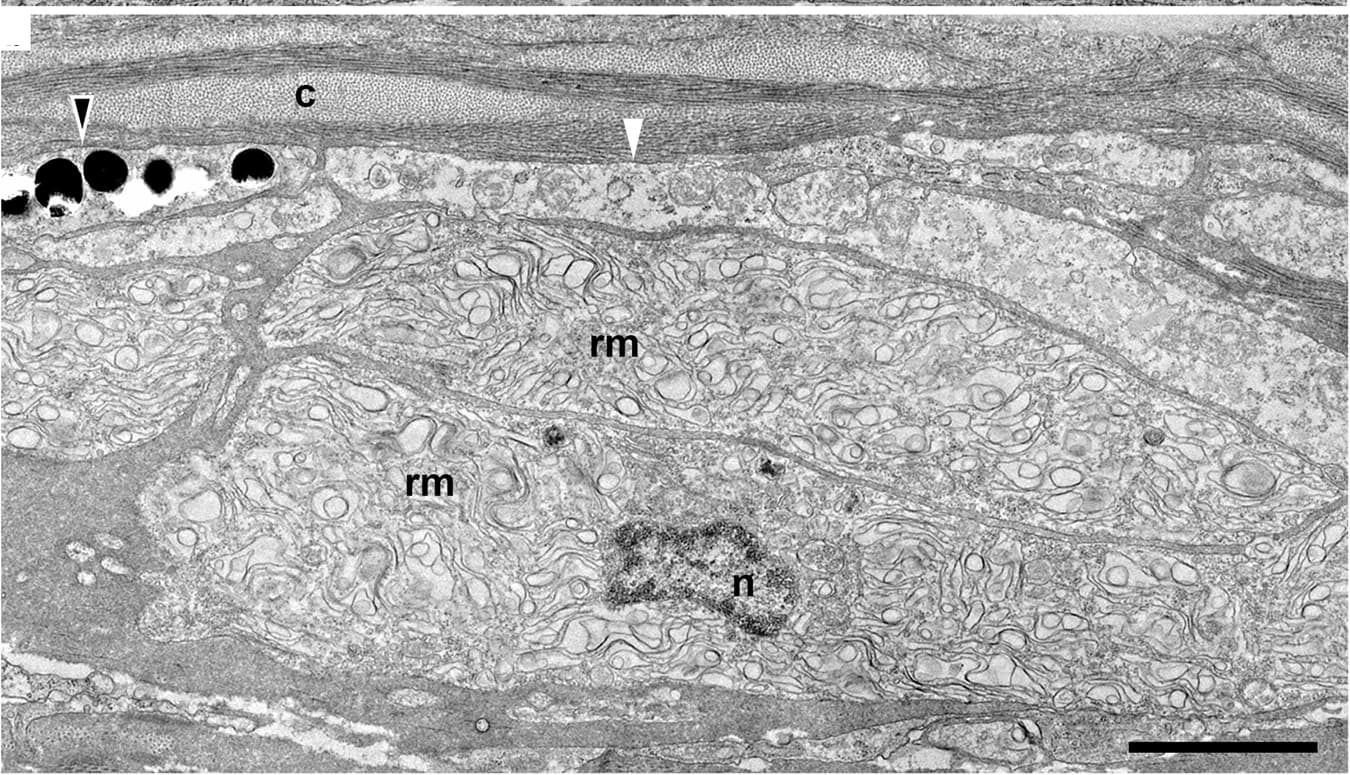 Open access visualization of Microscopy, Reticulated Membrane Structure, Chromatophores, Melanophore, Erythrophore