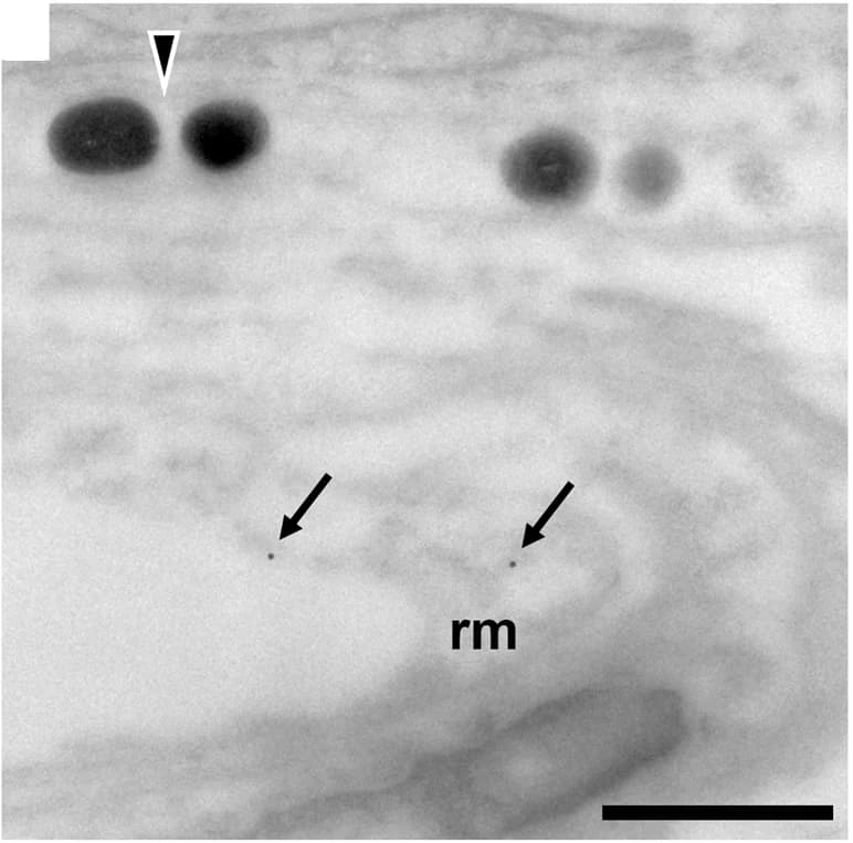 Open access visualization of Microscopy, Immunogold Labeling, SWS1 Opsin, Melanophores