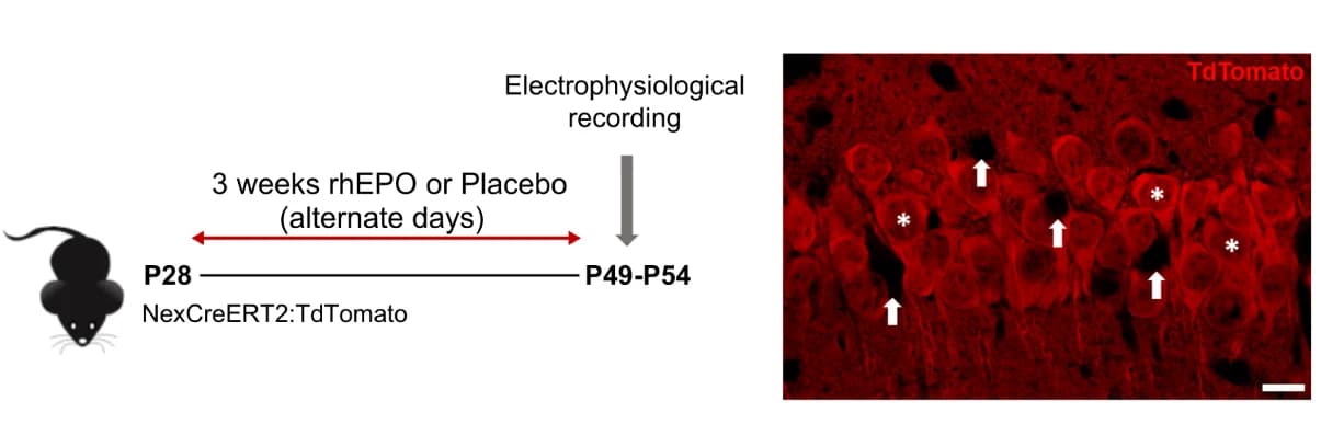 Open access visualization of Microscopy, Workflow, EPO/PL treatment, Immunohistochemistry, CA1 neurons