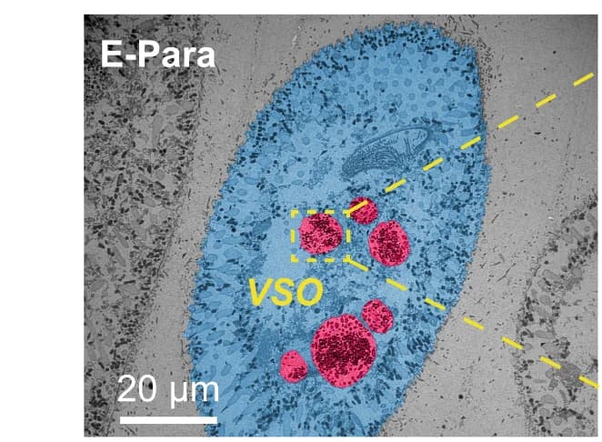 Open access visualization of Microscopy, TEM, Food Vacuoles, E-Para