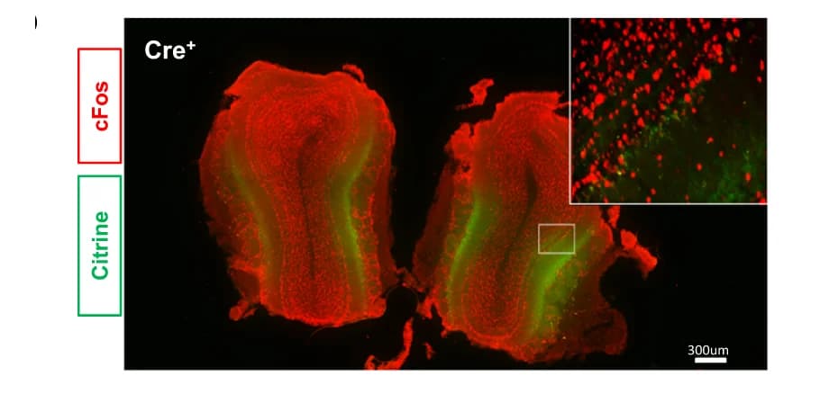 Open access visualization of Microscopy, Immunostaining, MOB, cFos