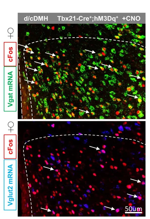 Open access visualization of Microscopy, Immunohistochemical staining, In situ hybridization, dDMH, Vgat
