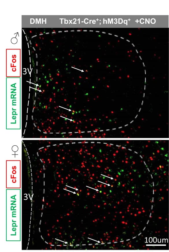 Open access visualization of Microscopy, Immunohistochemical staining, In situ hybridization, DMH, Lepr