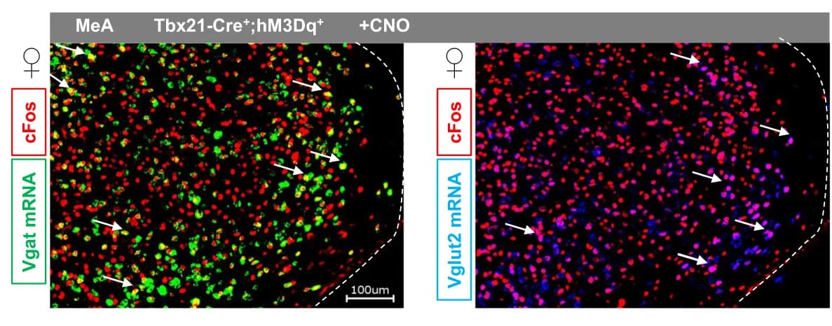 Open access visualization of Microscopy, MeA, Immunohistochemical staining, In situ hybridization, Vgat