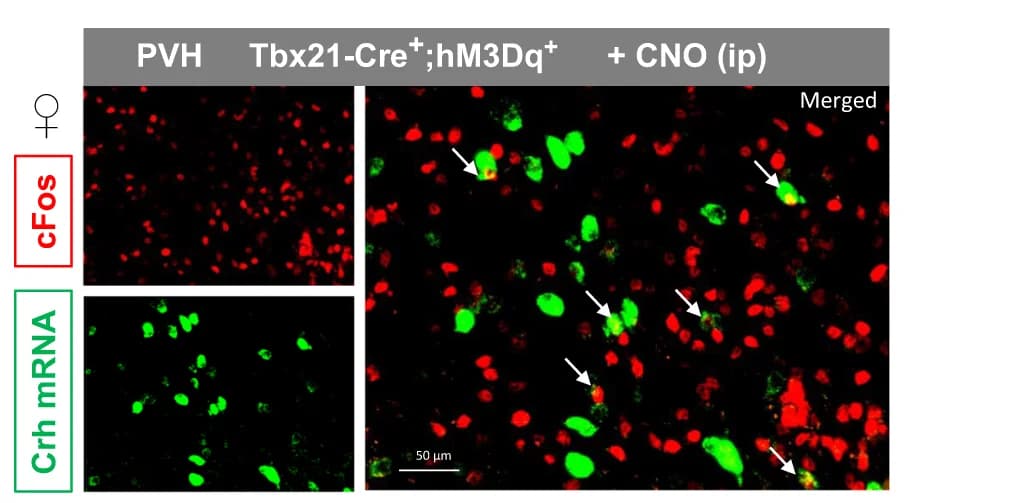 Open access visualization of Microscopy, Immunohistochemistry, In situ hybridization, Crh, cFos protein