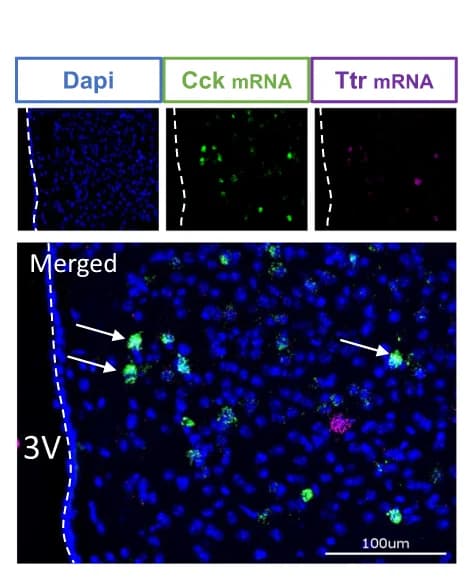Open access visualization of Microscopy, Dorsomedial Hypothalamus, Immunohistochemistry, In Situ Hybridization