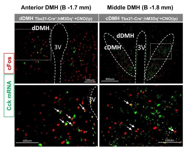 Open access visualization of Microscopy, Immunohistochemistry, In Situ Hybridization, Cck, cFos Protein