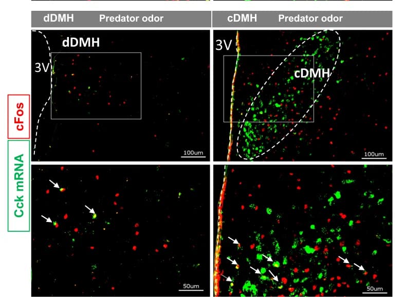 Open access visualization of Microscopy, Immunohistochemistry, In Situ Hybridization, Cck, cFos Protein
