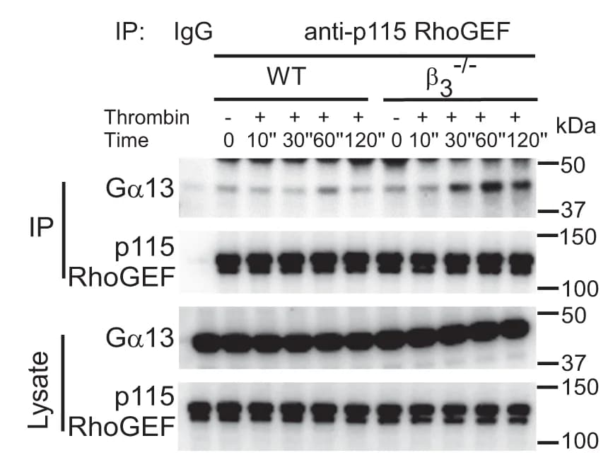 Open access visualization of Gel, p115RhoGEF, Ga 13, Mouse Platelets, Western blot