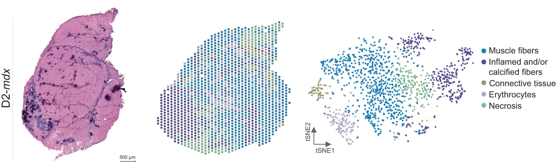Open access visualization of Microscopy, Scatter Plot, UMAP, HE Stained Section, Visium Spots