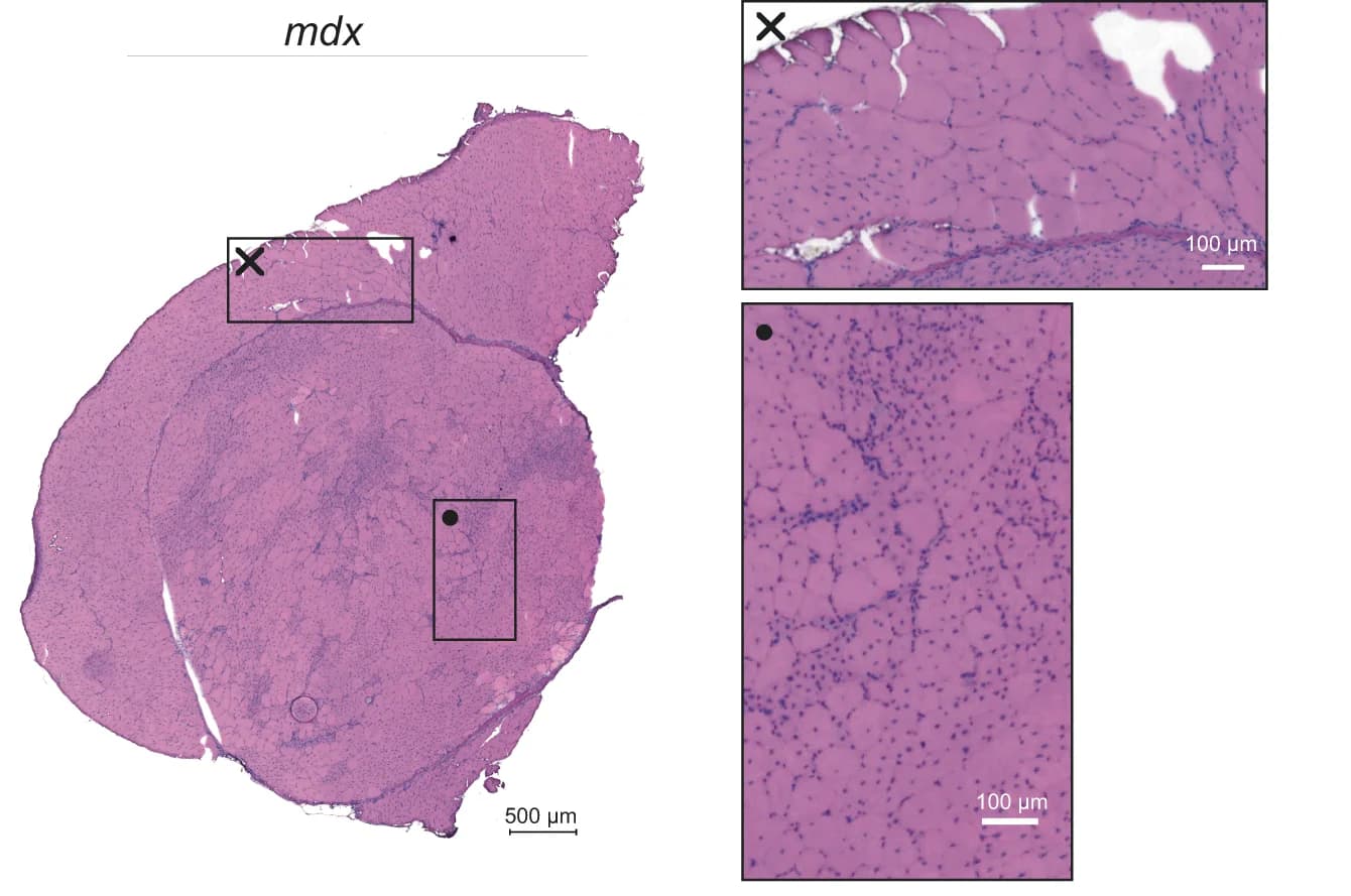 Open access visualization of Microscopy, mdx Quadriceps Sample, Muscle Fibers, Centralized Nuclei, Regenerated Muscle Fibers