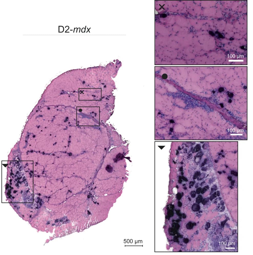 Open access visualization of Microscopy, HE Staining, D2-mdx, Fibrotic Infiltration, Myofibers
