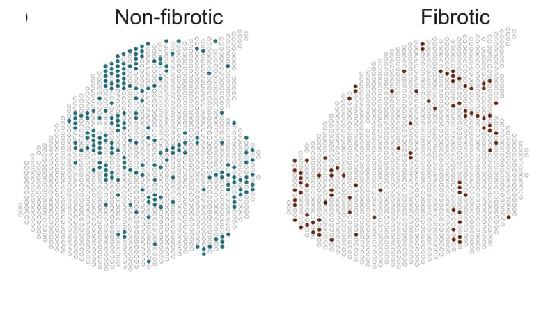 Open access visualization of Scatter Plot, Non-Fibrotic Spots, Fibrotic Spots
