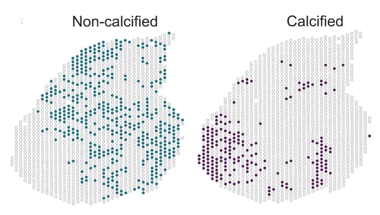 Open access visualization of Scatter Plot, Non-Calcified Spots, Calcified Spots, Differential Gene Expression Analysis