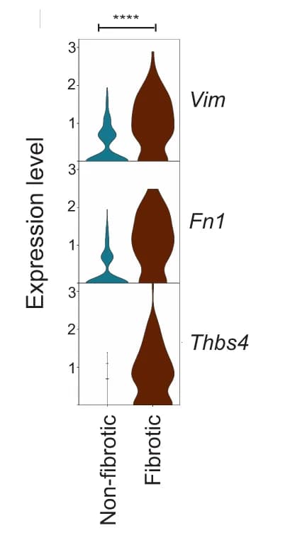 Open access visualization of Violin Plot, Gene Expression, Vim, Fn1, Thbs4
