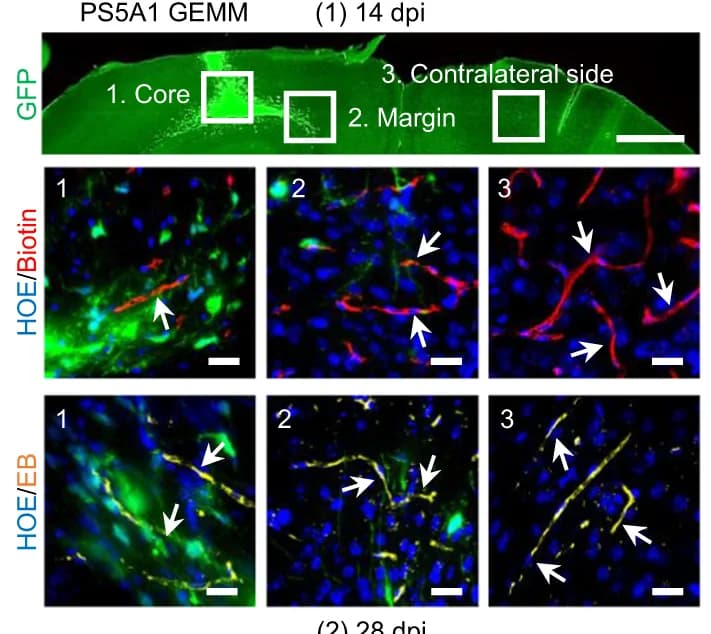 Open access visualization of Microscopy, BBTB Permeability, PS5A1 GEMM, EZ-link Biotin, Evans Blue