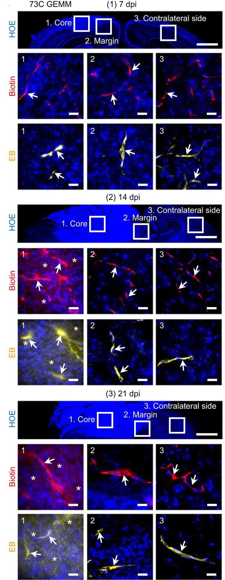 Open access visualization of Microscopy, BBTB Permeability, 73 C BBTB, EZ-link Biotin, Evans Blue