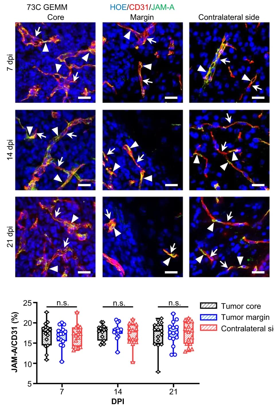 Open access visualization of Box Plot, Microscopy, IHC staining, Junctional protein, JAM-A