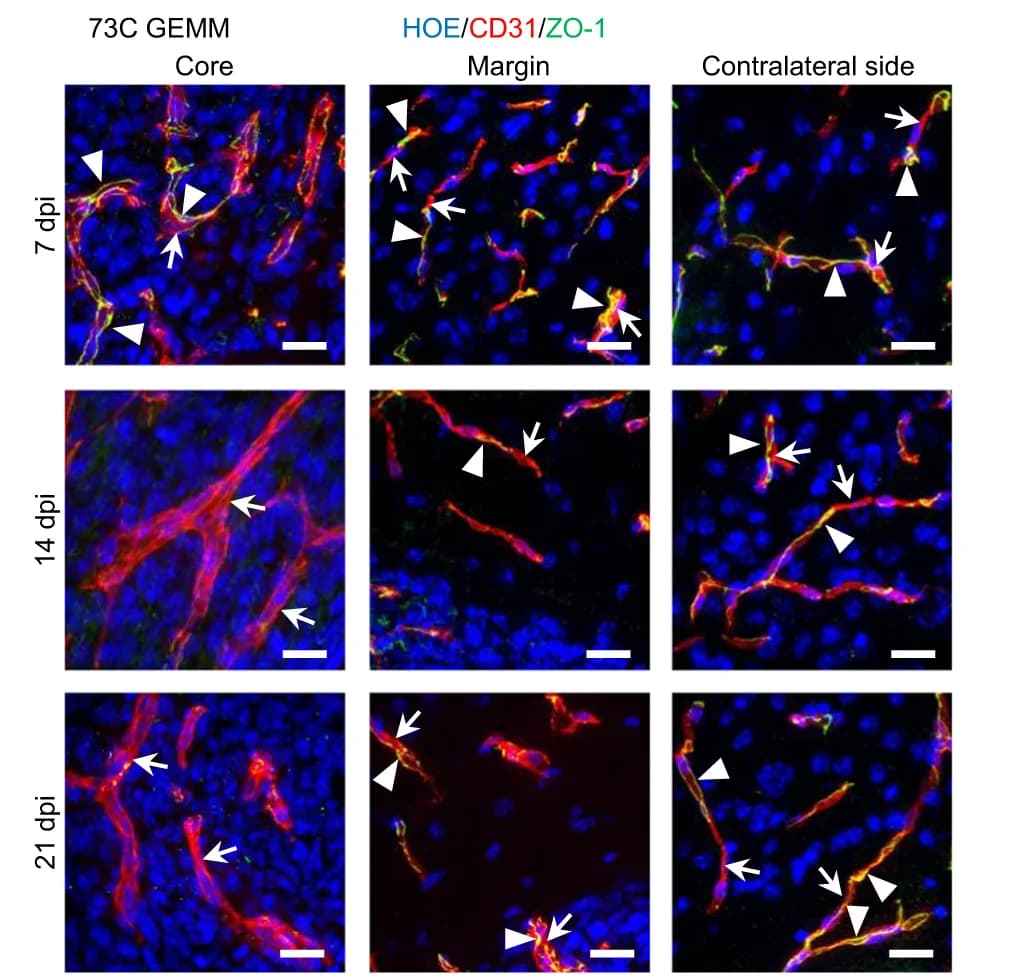 Open access visualization of Microscopy, IHC staining, Junctional protein, ZO-1, 73 C GEMM