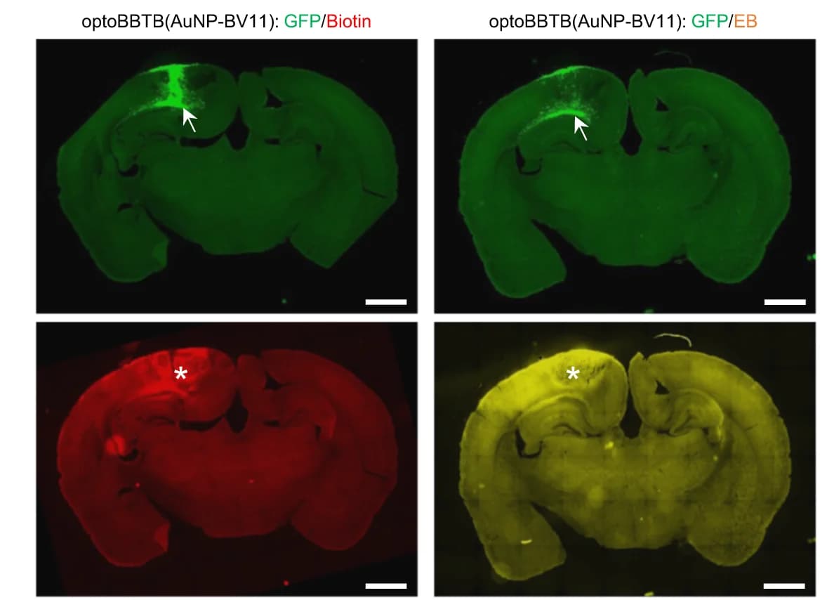 Open access visualization of Microscopy, EZ-link Biotin, Evans Blue, OptoBBTB, ps Laser