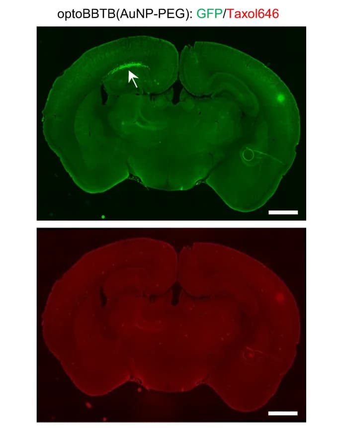 Open access visualization of Microscopy, OptoBBTB, ps Laser, AuNP-PEG, Taxol646