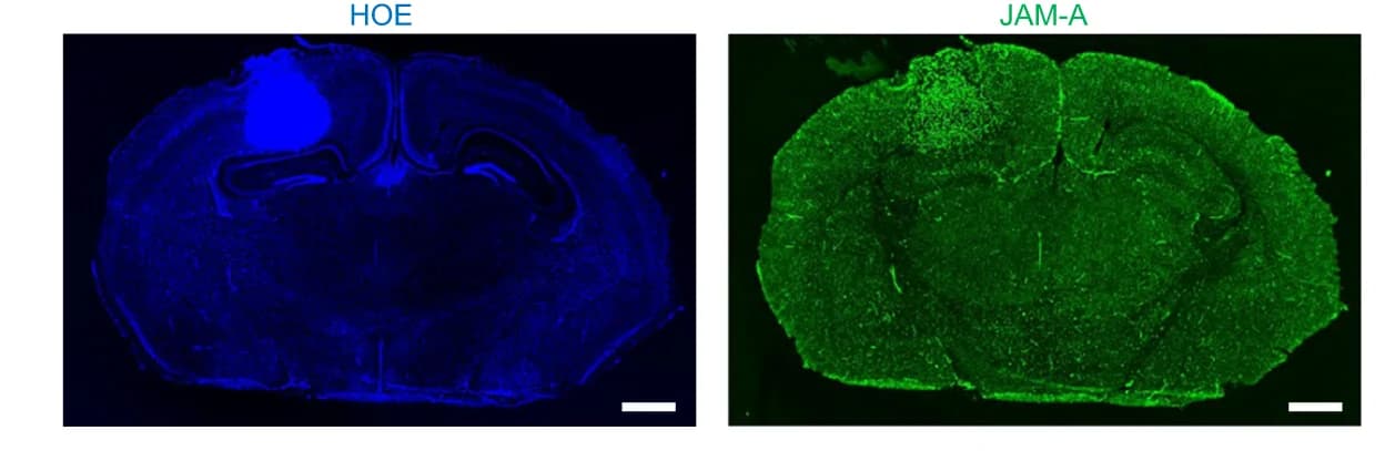 Open access visualization of Microscopy, Photo, IHC Staining, JAM-A Overexpression, 73 C GEMM