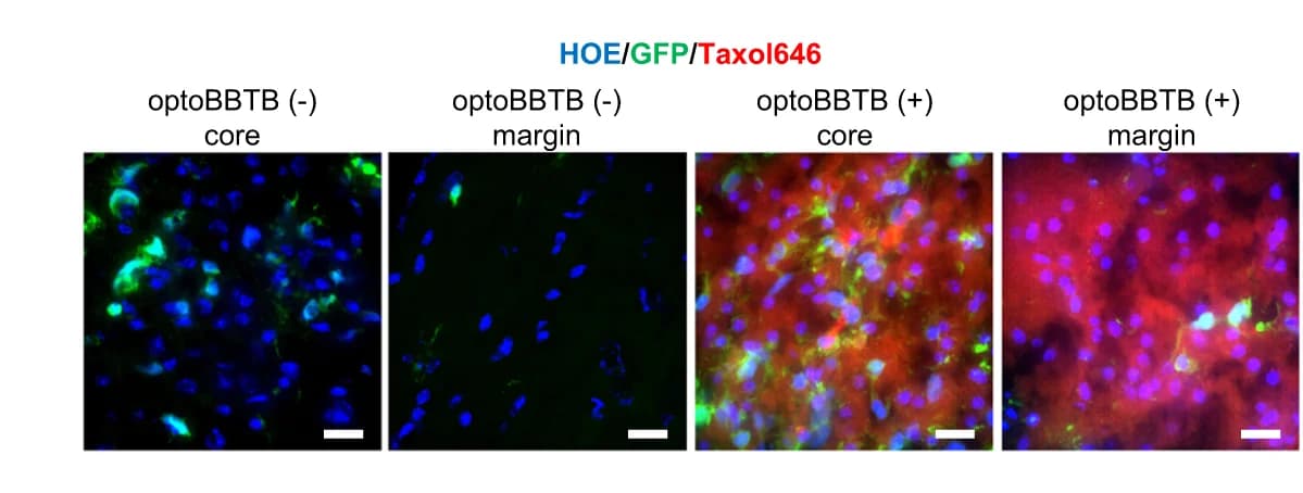 Open access visualization of Microscopy, OptoBBTB, Taxol646, Tumor Core, Tumor Margin