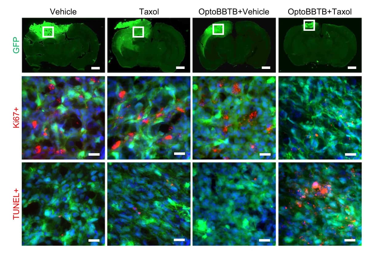 Open access visualization of Microscopy, Tumor Area, GFP Fluorescent, Ki67 Staining, Cell Proliferation