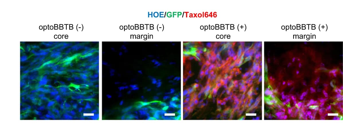 Open access visualization of Microscopy, OptoBBTB, Fluorescent Taxol646, Tumors