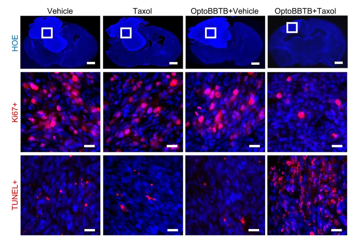 Open access visualization of Microscopy, Tumor Size, Fluorescent Imaging, Hoechst Staining, Cell Nuclei