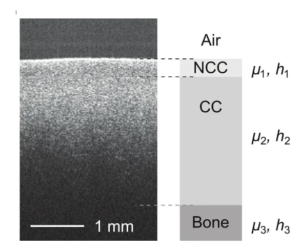 Open access visualization of Microscopy, Cross-sectional OCT Image, Noncalcified Cartilage, Calcified Cartilage, Bone