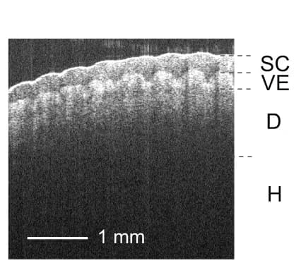 Open access visualization of Microscopy, OCT Image, Fingertip Skin, Stratum Corneum, Viable Epidermis