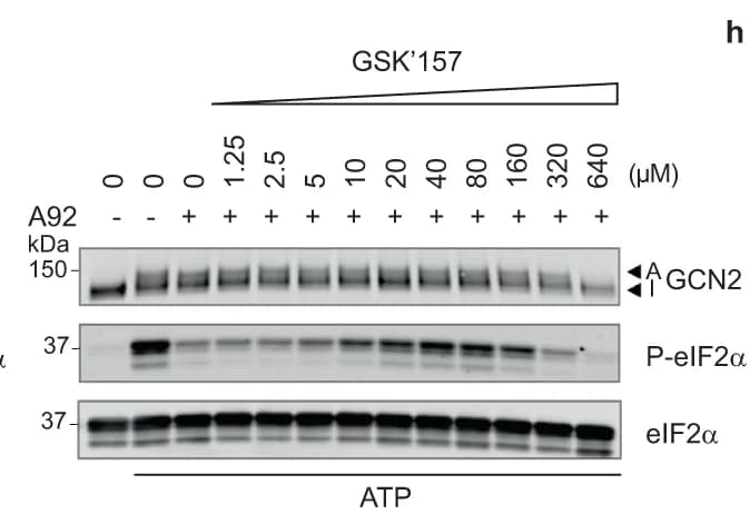 Open access visualization of Gel, Immunoblots, Proteins, In Vitro Kinase Reaction, ATP
