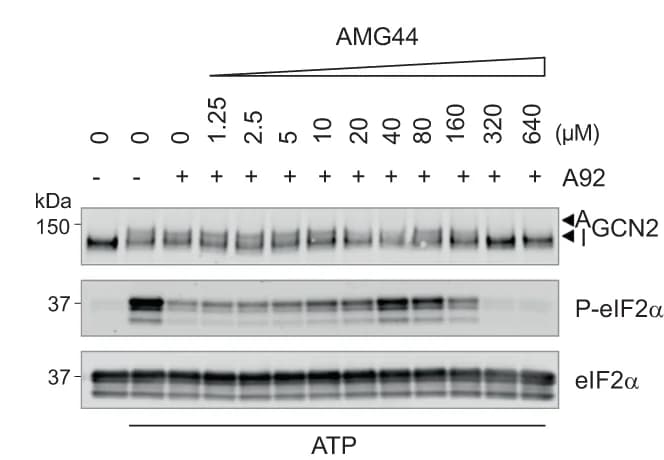 Open access visualization of Gel, Immunoblots, Proteins, In vitro kinase reactions, ATP
